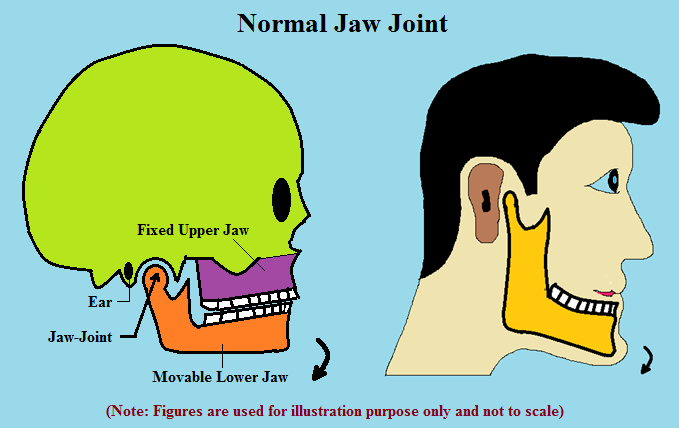 Causes of jaw pain and dysfunction