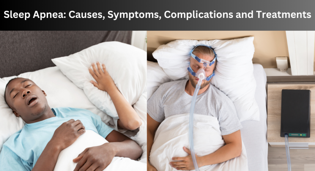 Sleep Apnea: Causes, Symptoms, Complications and Treatments