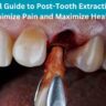 Post-tooth extraction care