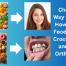 Foods that Prevent Crooked Teeth